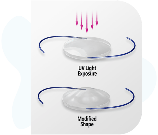 RxSight® Light Adjustable Lens™ at Magruder Laser Vision