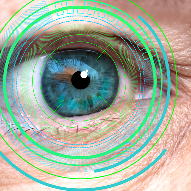 Implantable contact lenses technology in Orlando FL